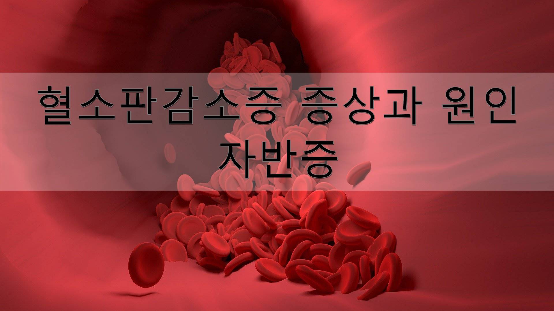 혈소판감소증
