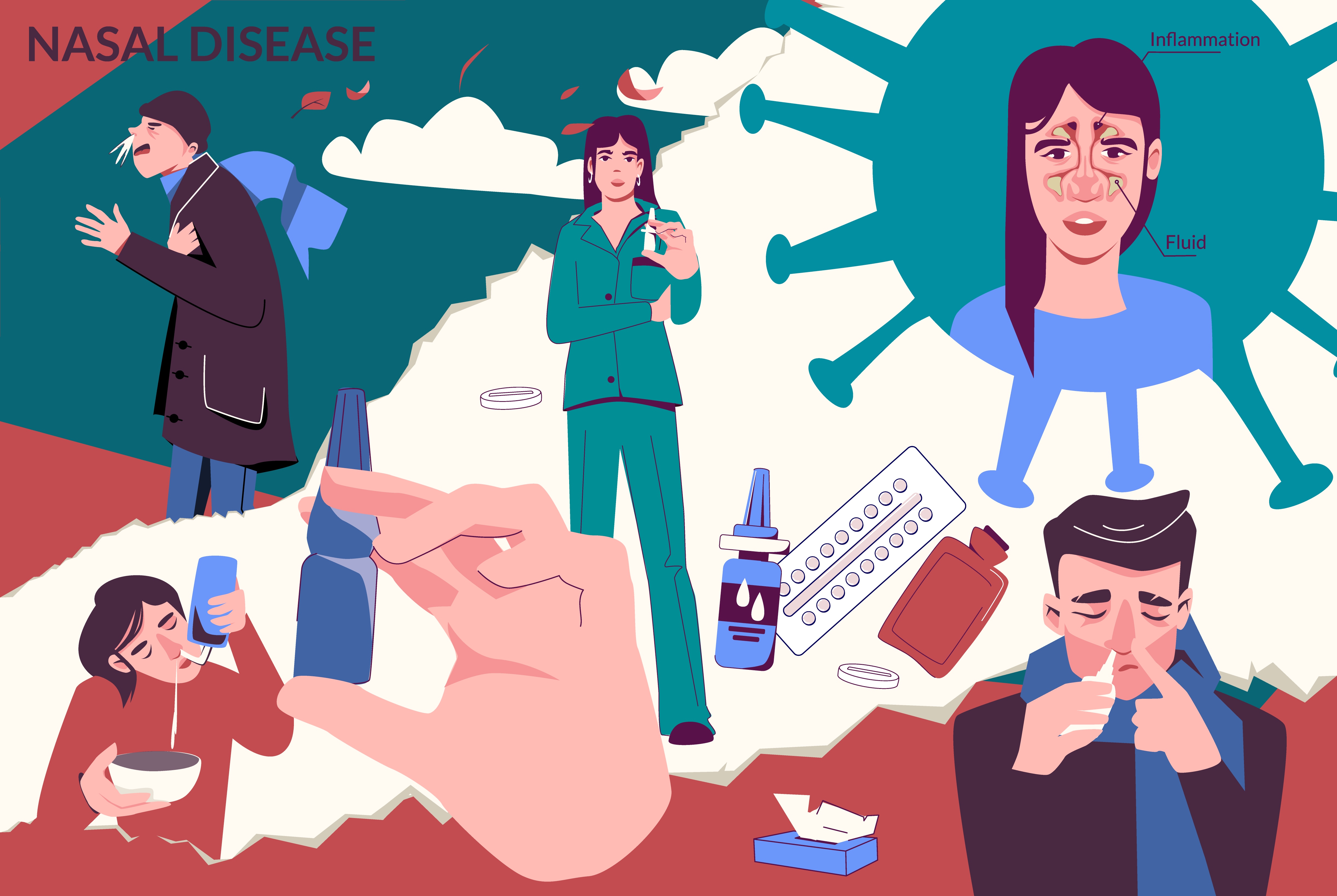 코 내부 관리 하는 방법