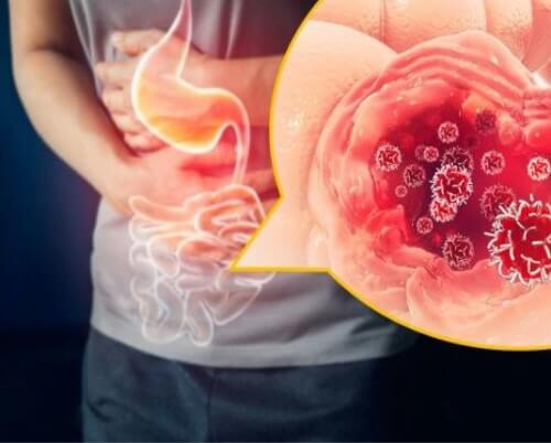 아스파탐 발암물질