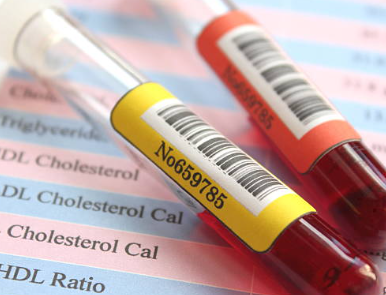 중성지방 낮추는 방법, 중성지방 정상수치