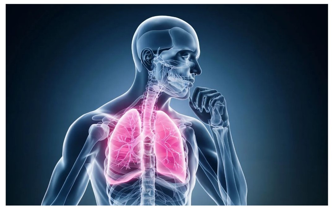 감기 걸린 사진