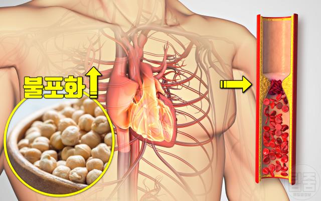 병아리콩 매일 먹으면 효능 하루섭취량 콜레스테롤 심장