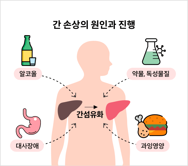 간 기능을 지키는 데 필요한 영양소
