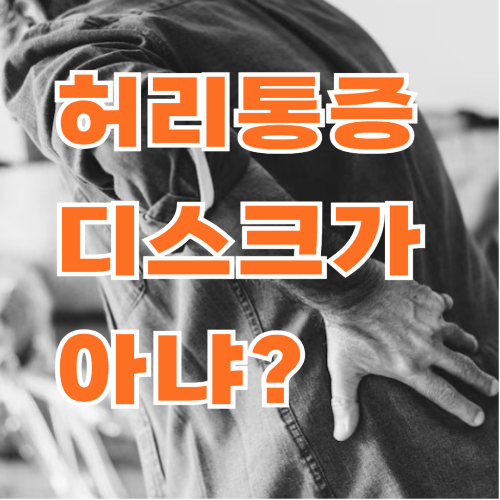허리가 뻐근하고 땡길 때, 디스크가 아닐 수도
