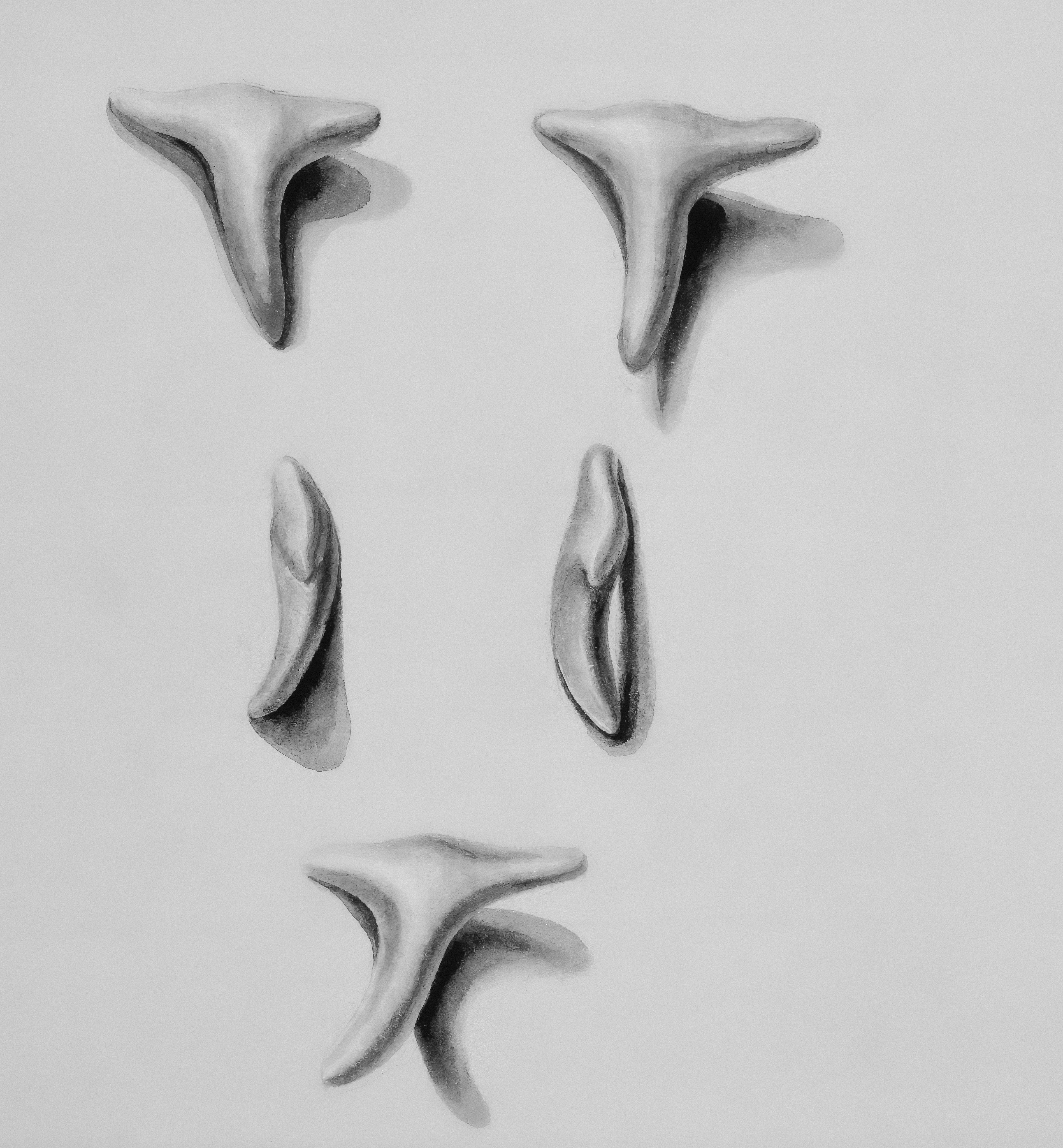 요실금 치료 수술 방법 요실금 수술 후 회복기간 / 요실금 건강보험 적용 시 수술 비용