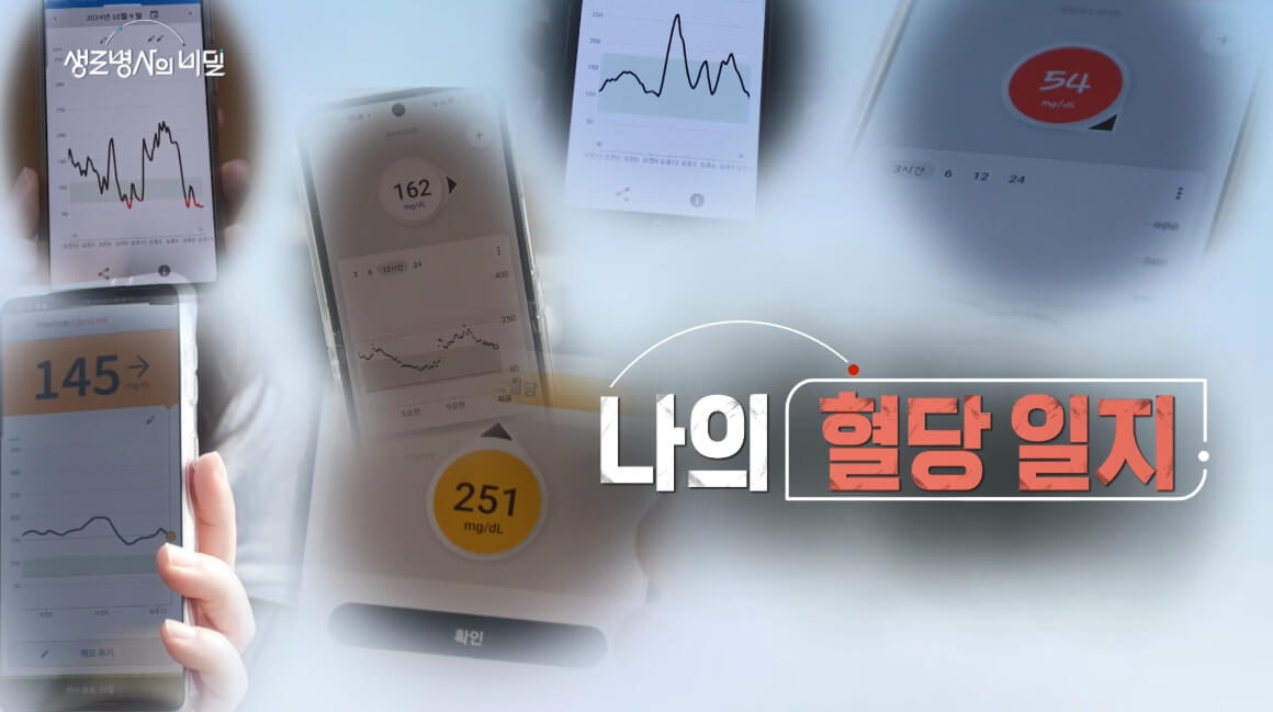 생로병사의 비밀 연속혈당측정기