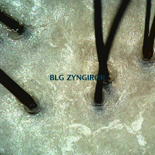 피나모아 복용 20주차 - 정수리 위치 두피 모습이다.