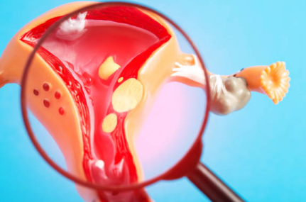 자궁근종 증상&amp;#44; 수술후 회복기간&amp;#44; 크기별 치료 총정리 (2024ver)