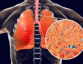 요즘 A형 vs B형 독감 증상 차이
