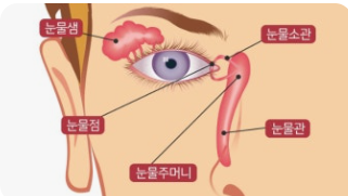 눈물 과다 분비 원인과 치료 관련 사진
