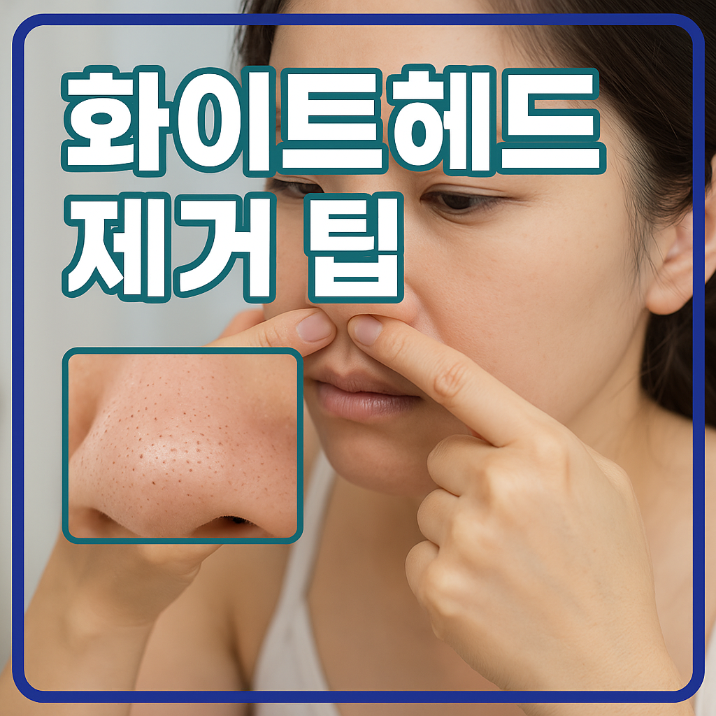 화이트헤드 제거 팁