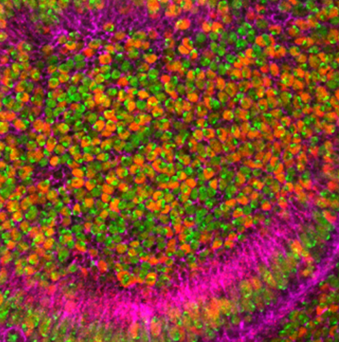 오트밀 효능 : 고단백