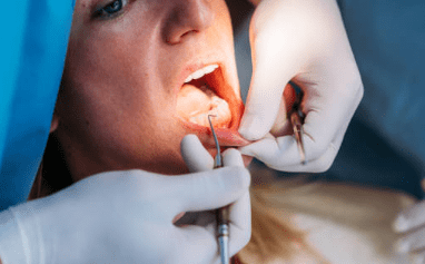 잇몸 염증 치료약