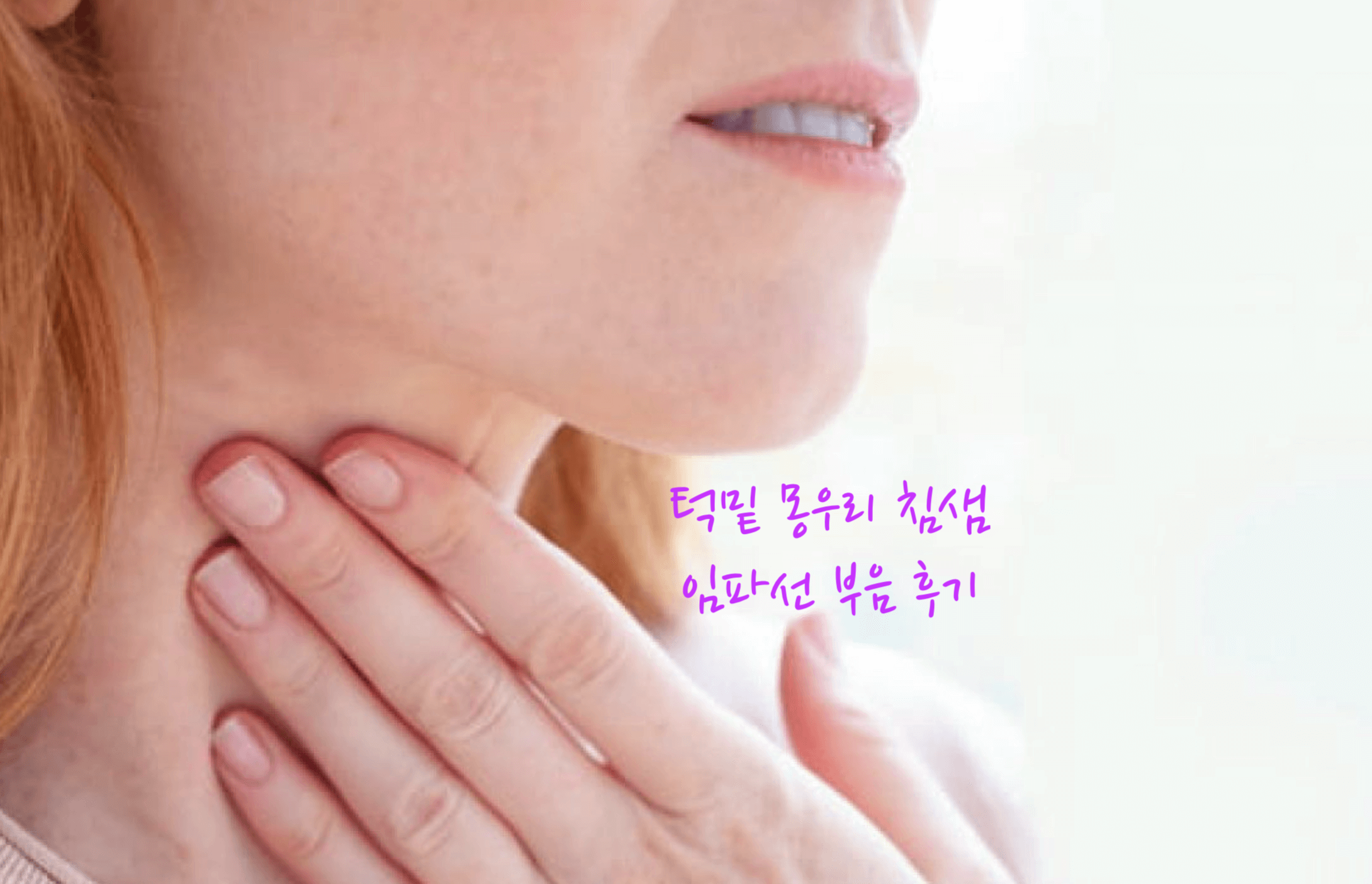 턱밑 몽우리