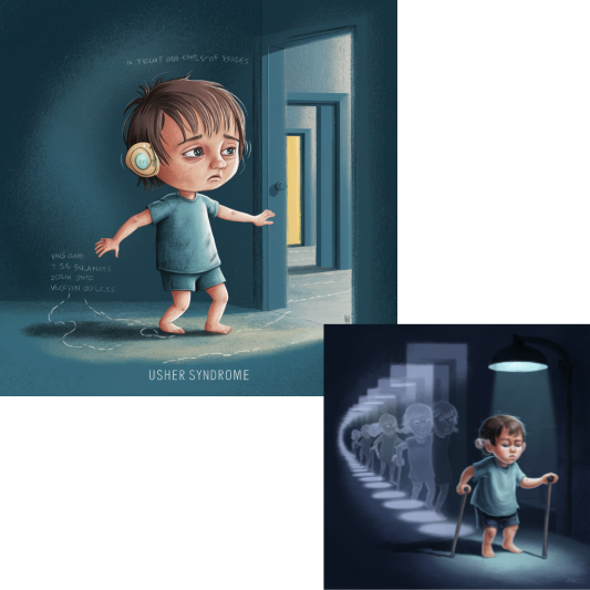 어셔 증후군의 증상