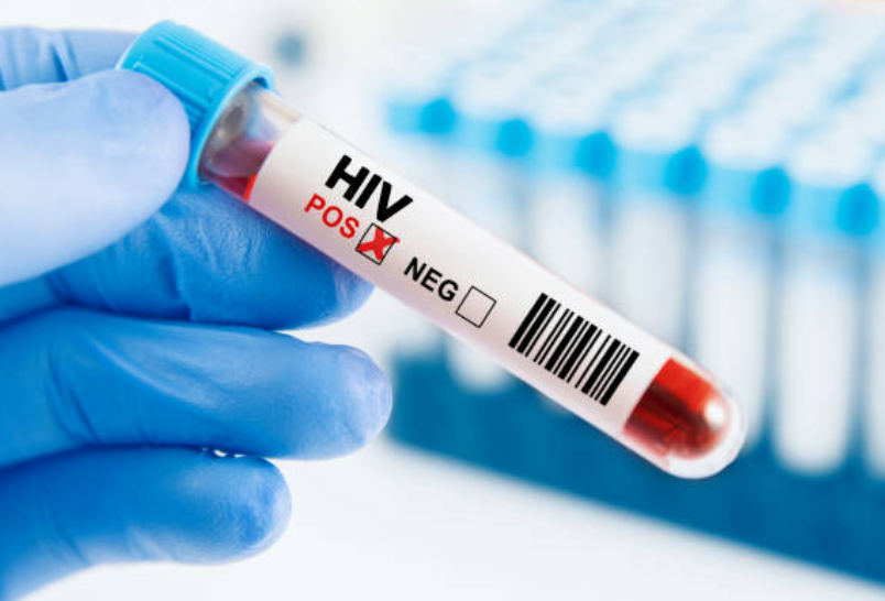 AIDS 와 관련된 사진