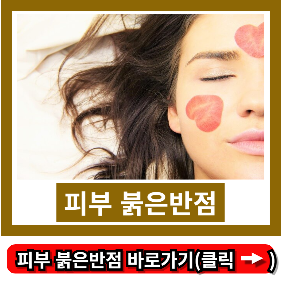 피부 붉은반점