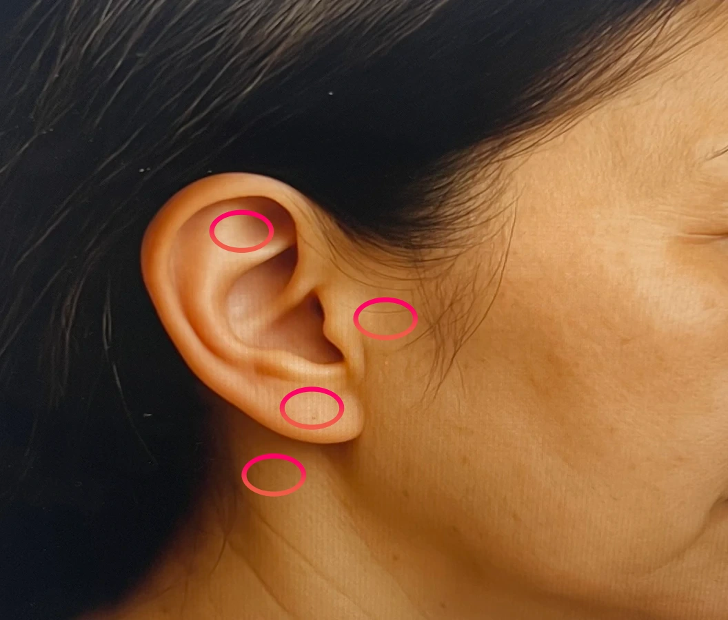 급속케어-시-붙이는법