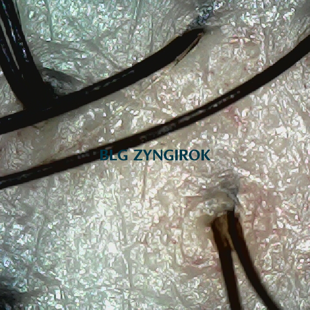 탈모 극복 프로젝트 - 뒷머리 두피 모습이다.