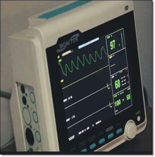 전해질 검사기