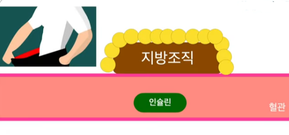 복구비만 개선