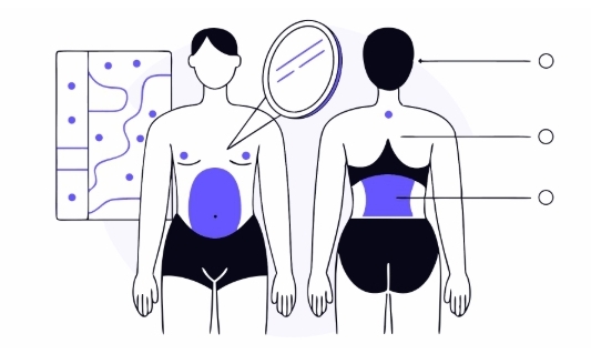 간경화 치료 과정