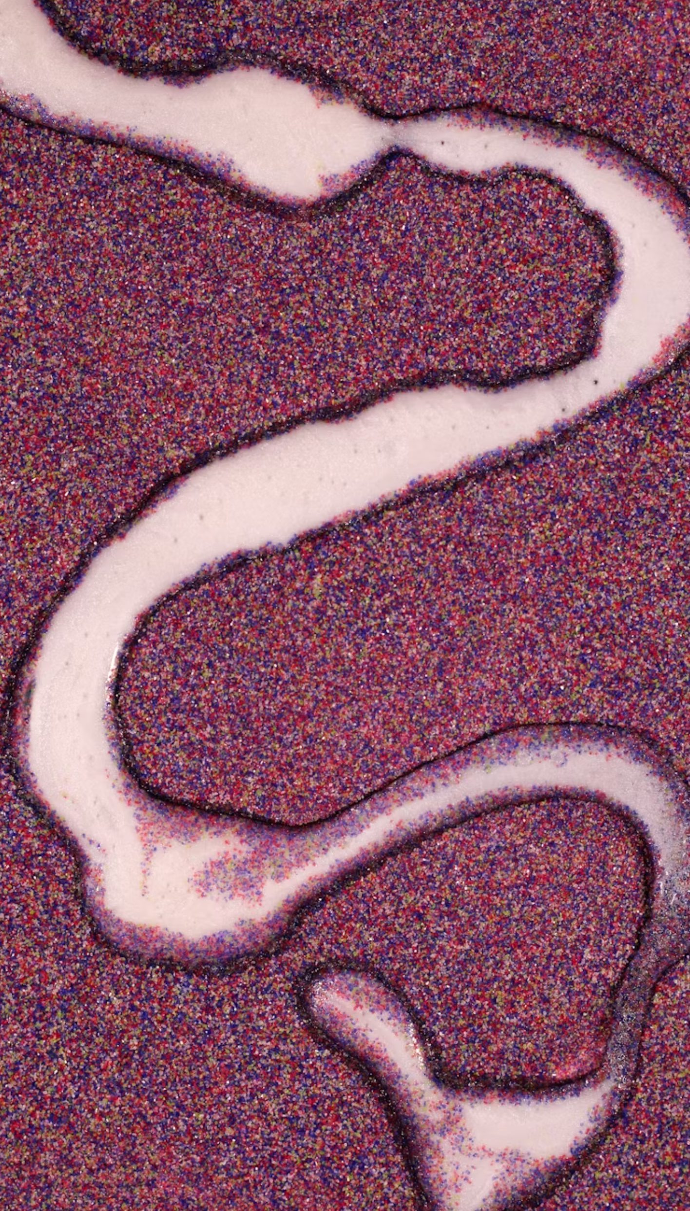 헬리코박터균 양성