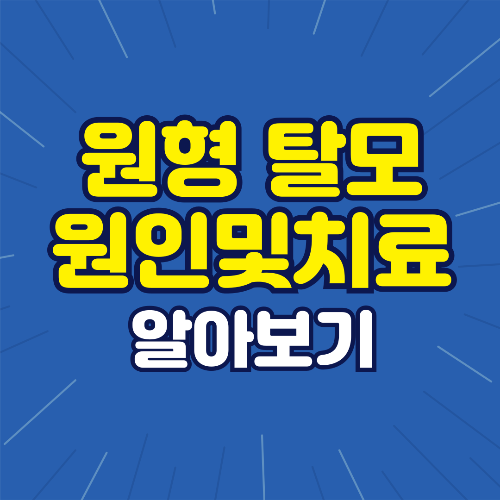 원형탈모 원인 및 치료