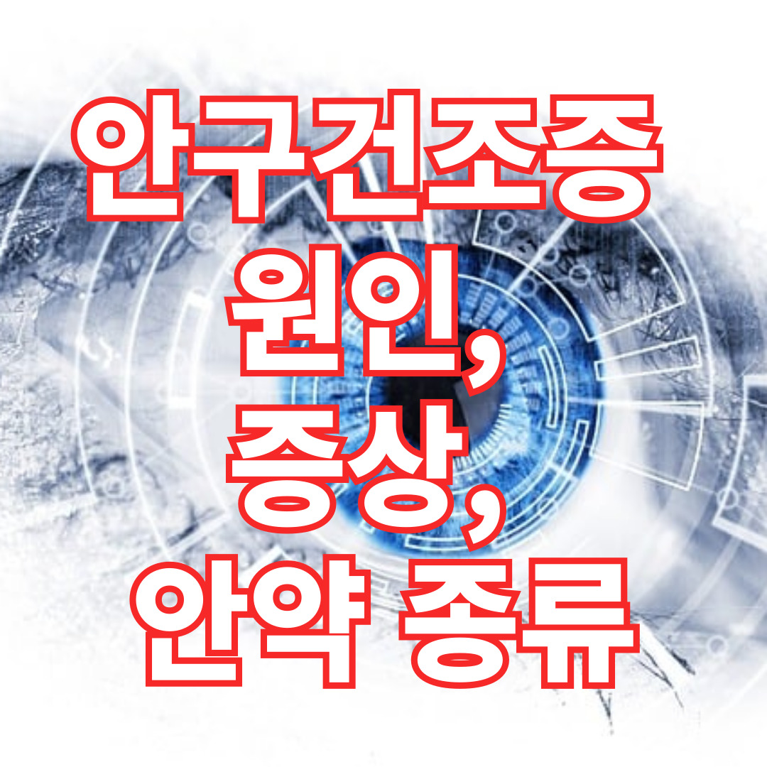 안구건조증의 원인, 증상, 안약 종류