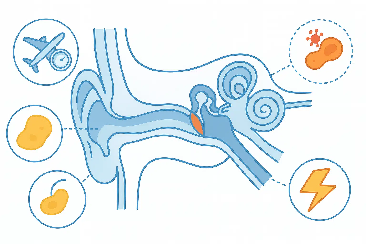 귀 내부 단면 구조 인포그래픽, 기압 변화&middot;염증&middot;귀지&middot;신경 문제 등 다양한 원인