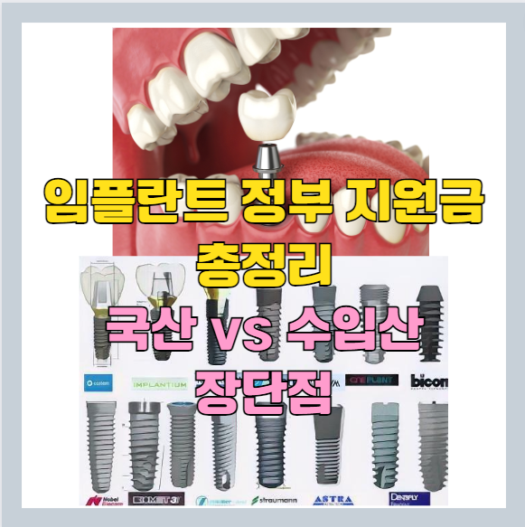2023 임플란트 지원금 총 정리 및 종류별 장 단점