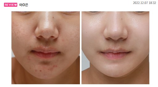 고혼진 화장품 가격, 최저가 전략