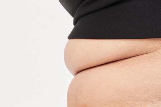 BNR17 유산균 : 체지방 감소 효과, 논문·리뷰로 검증해봤습니다