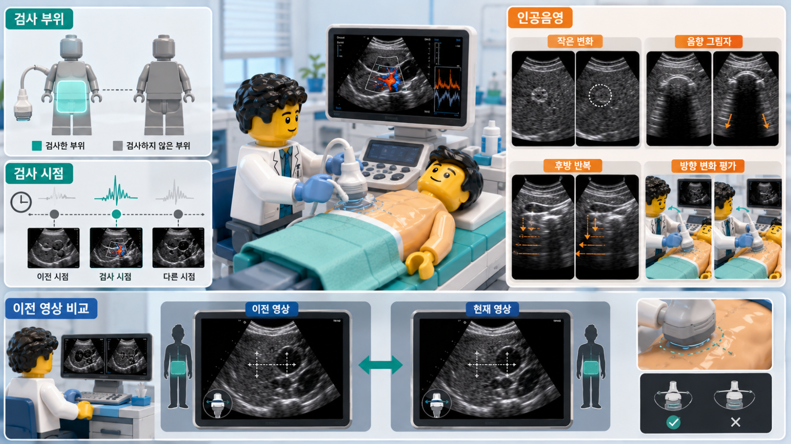 초음파검사의 관찰 범위와 검사 시점, 인공음영 및 이전 영상 비교를 설명하는 의료 인포그래픽