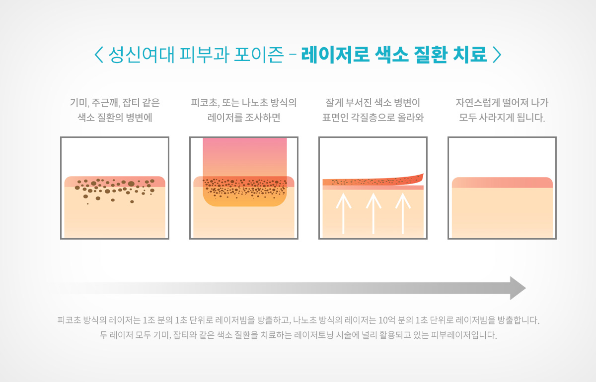 아이라인 제거