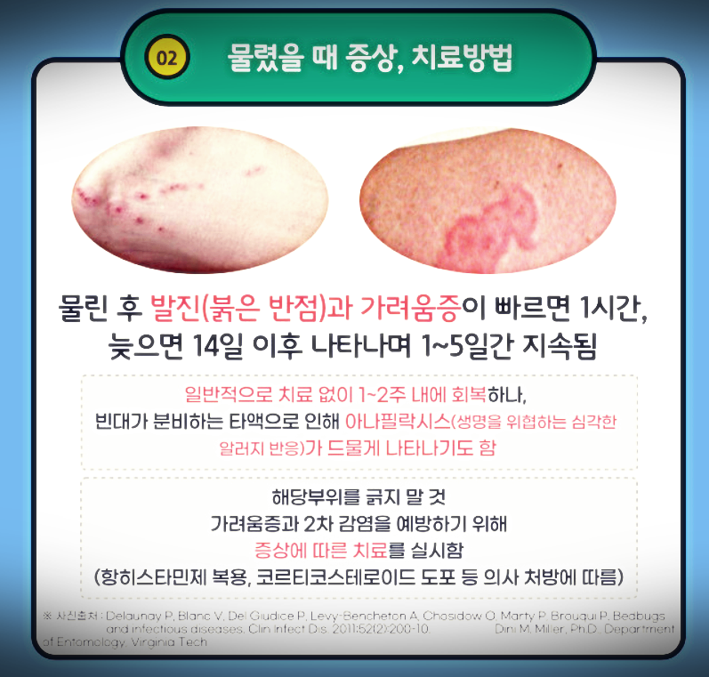 빈대 물리 증상