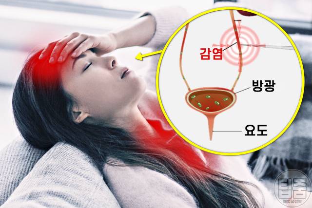 요로결석 증상 고열 식은땀 요로결석 신장결석 차이 요로결석자연배출