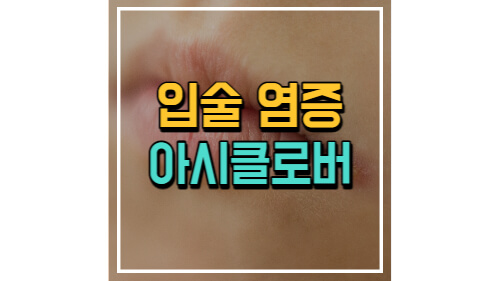 포스팅 썸네일 이미지