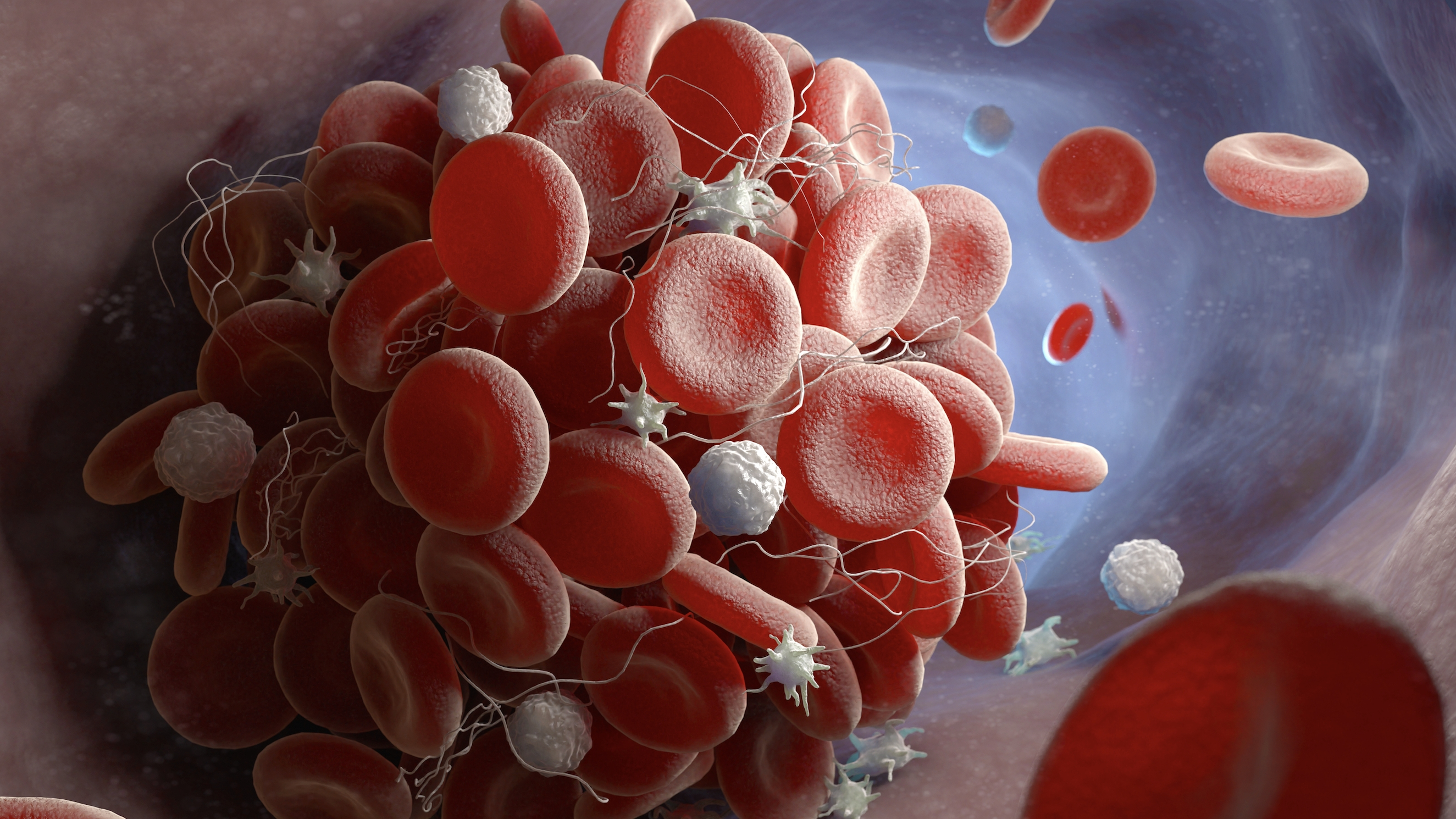 혈액 응고 장애