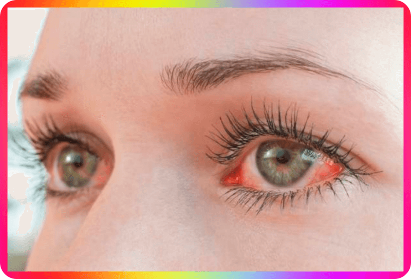 드림렌즈 안구통증 부작용