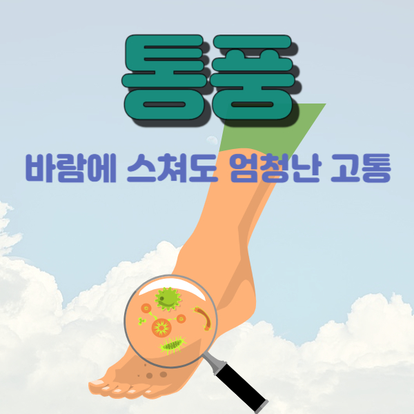통풍: 요산의 무법자