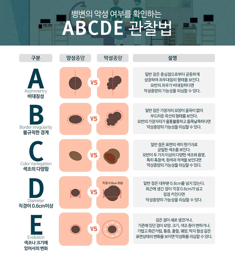 abcd 관찰법