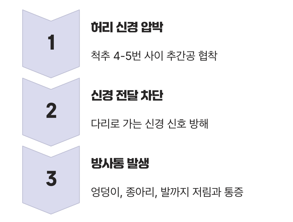 왜 통증은 허리가 아닌 다리에 나타날까?