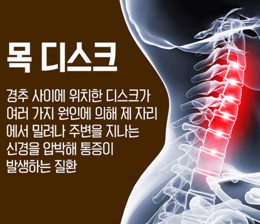 목디스크