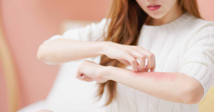 음식 알러지