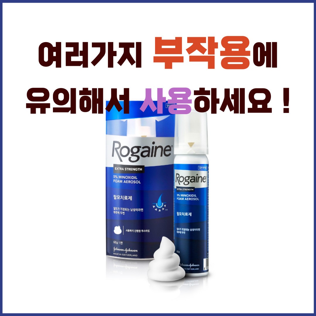 로게인5%폼에어로졸 부작용