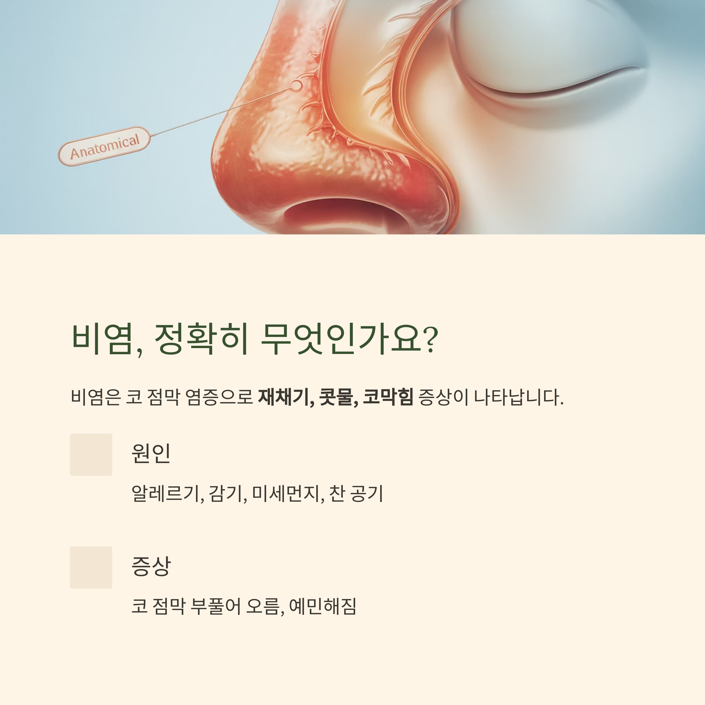 비염의 정의와 증상을 설명하는 이미지, 코의 해부 구조 일러스트와 함께 원인 및 주요 증상을 안내