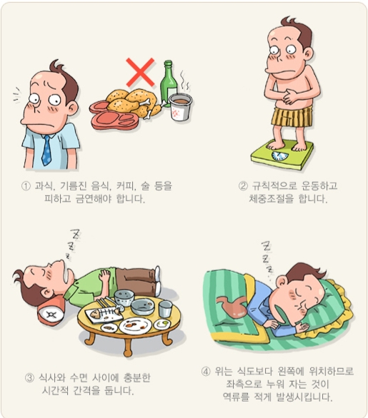 역류성 식도염 재발 이유&amp;#44; 약을 먹어도 계속 불편한 진짜 원인