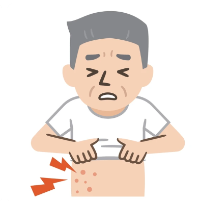 바늘로 찌르는 듯하거나, 화상 같은 느낌, 또는 둔한 통증