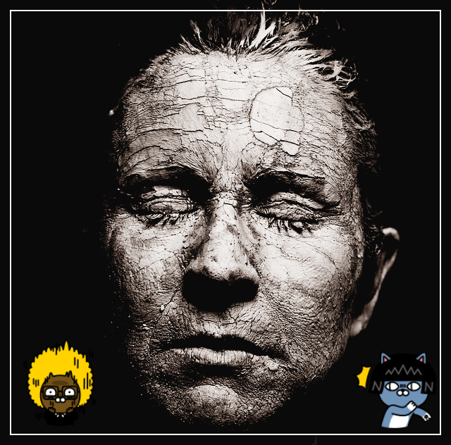 나이가 들수록 피부가 나빠지는 원인